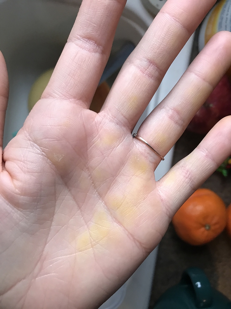 Yellow on hands like highlighter, except it’s not health