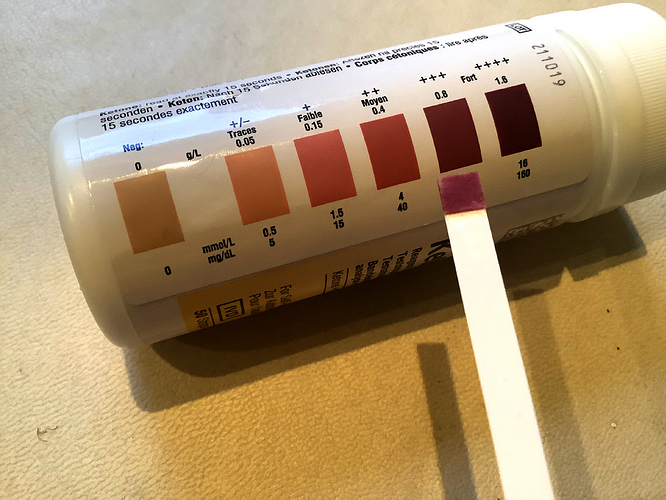 Urine%20test