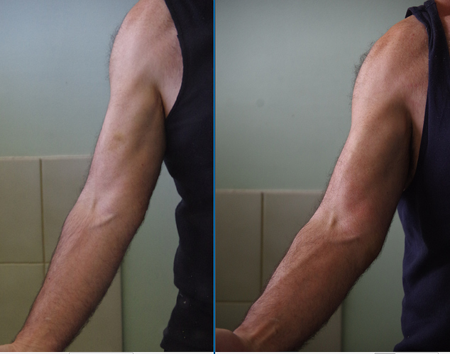 me%20arm%2085-84kg
