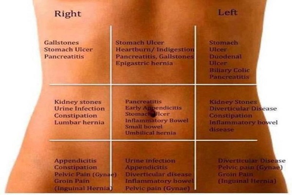 abdominal-pain-map