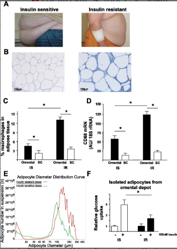 adiponectin2