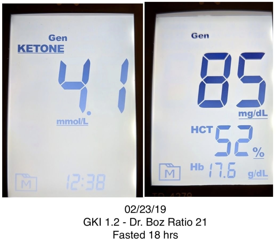 Dr Boz Calculates levels of autophagy using blood sugar/blood ketones