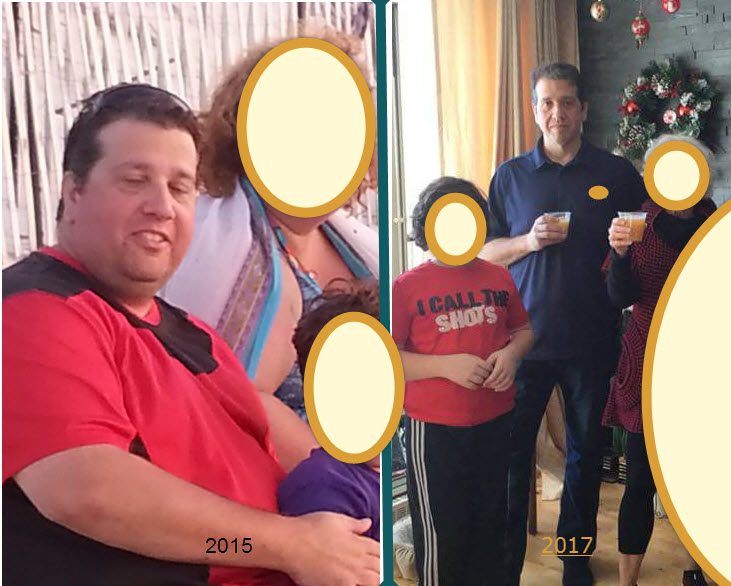 before-after_Pat
